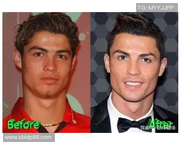 整容前后对比照解析:男足球星颜值变化大集合 整容前后对比照解析:男足球星颜值变化大集合